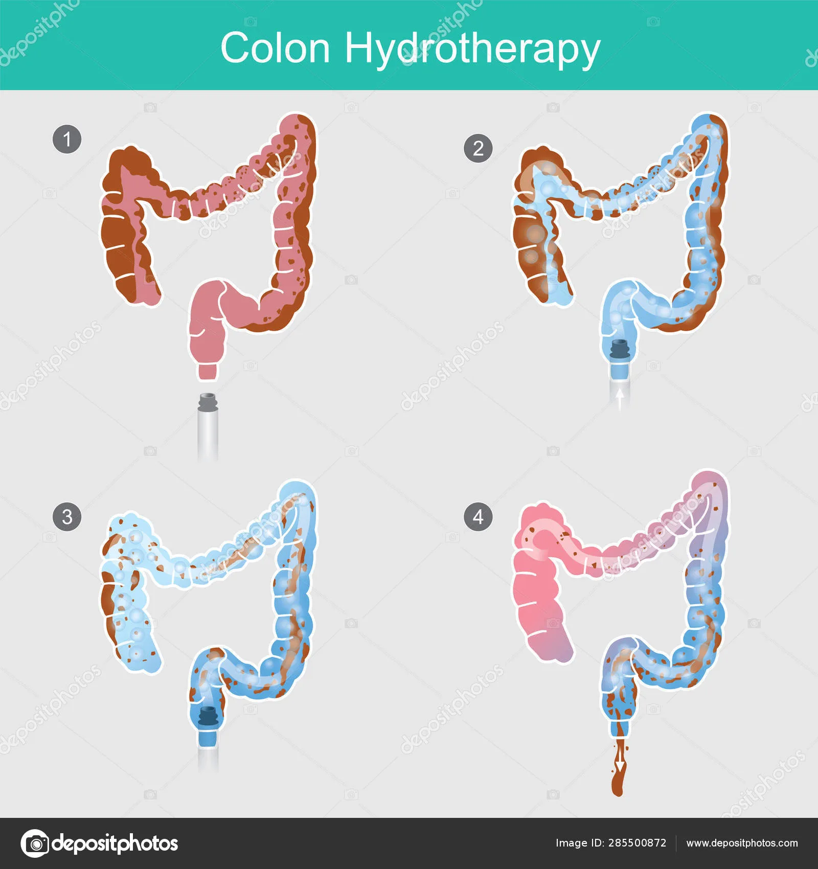 How to do an intestine cleanse?