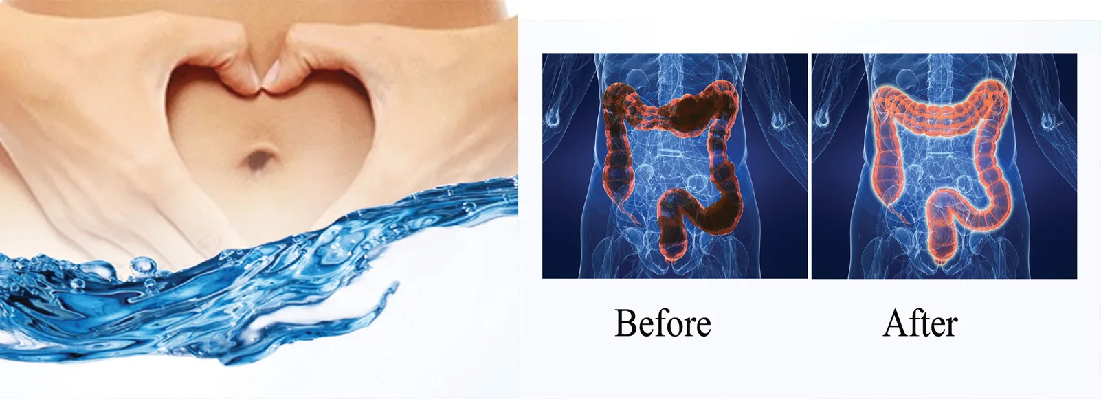 How Can I Clean My Colon Out?