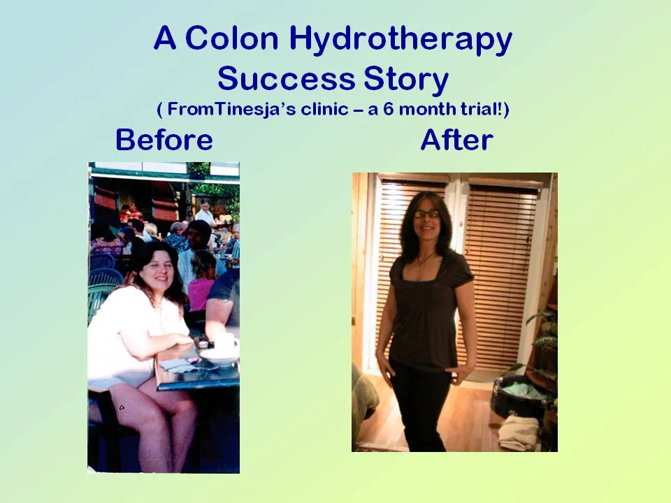 Colon Hydrotherapy Device 177
