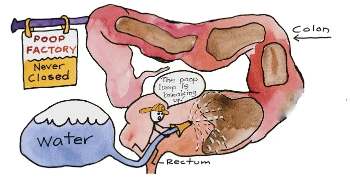 Colon Hydrotherapy
