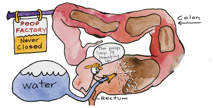 colonic hydrotherapy